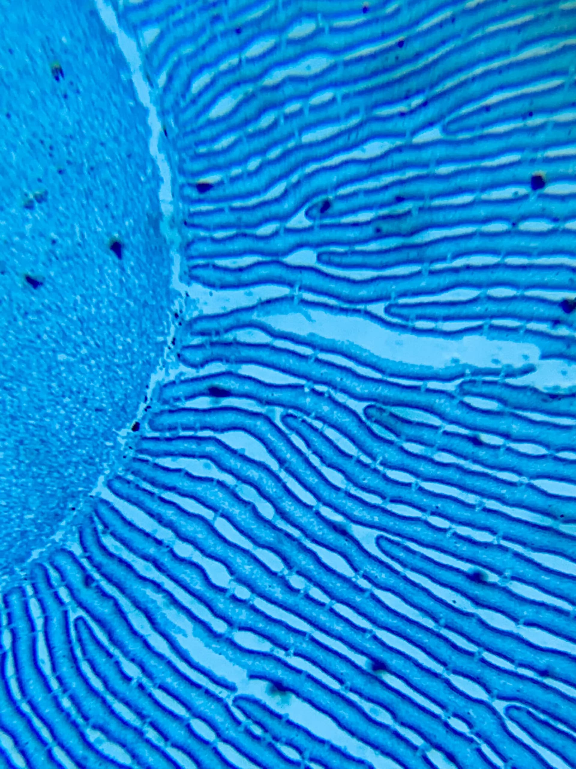 Microscopic cross-section of coprimus mushroom