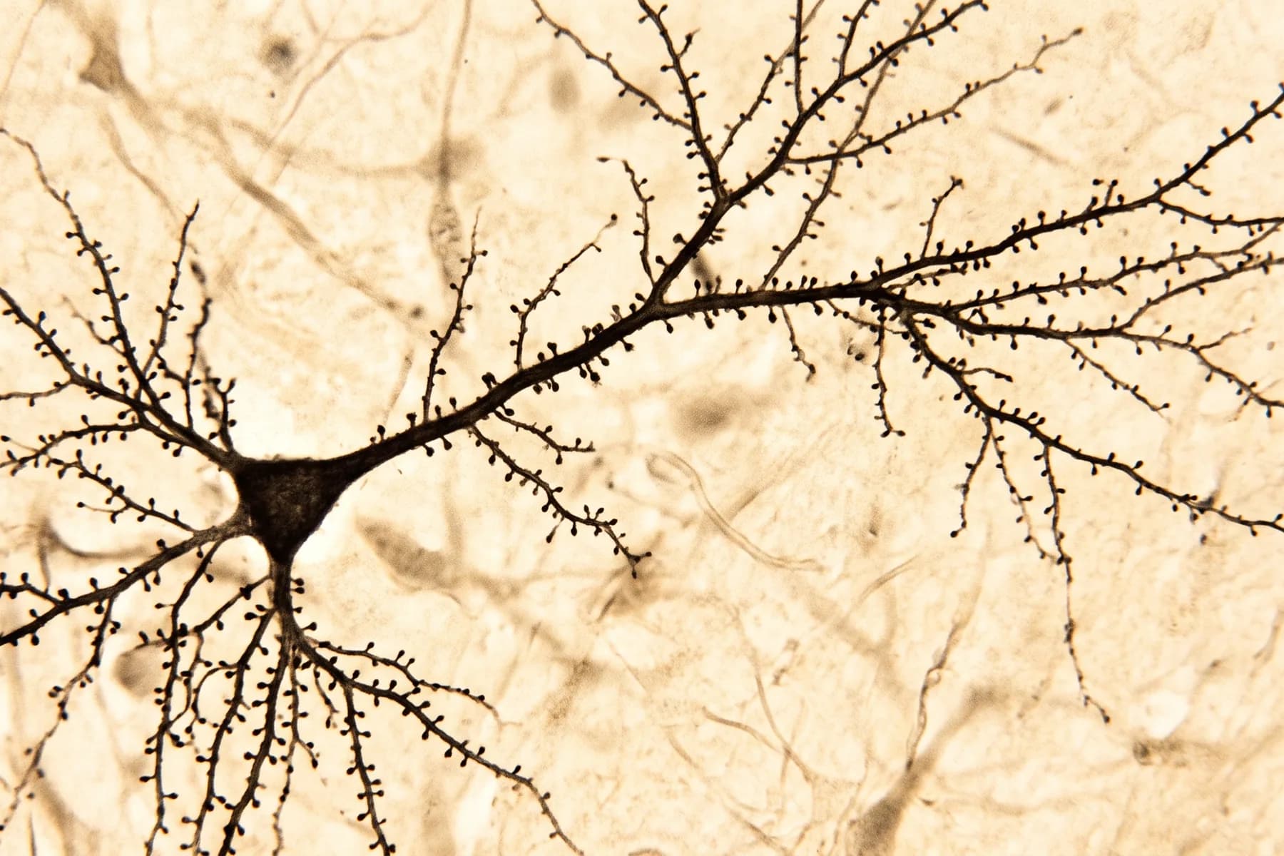 A Golgi-stained pyramidal neuron, its dendrites studded with spines