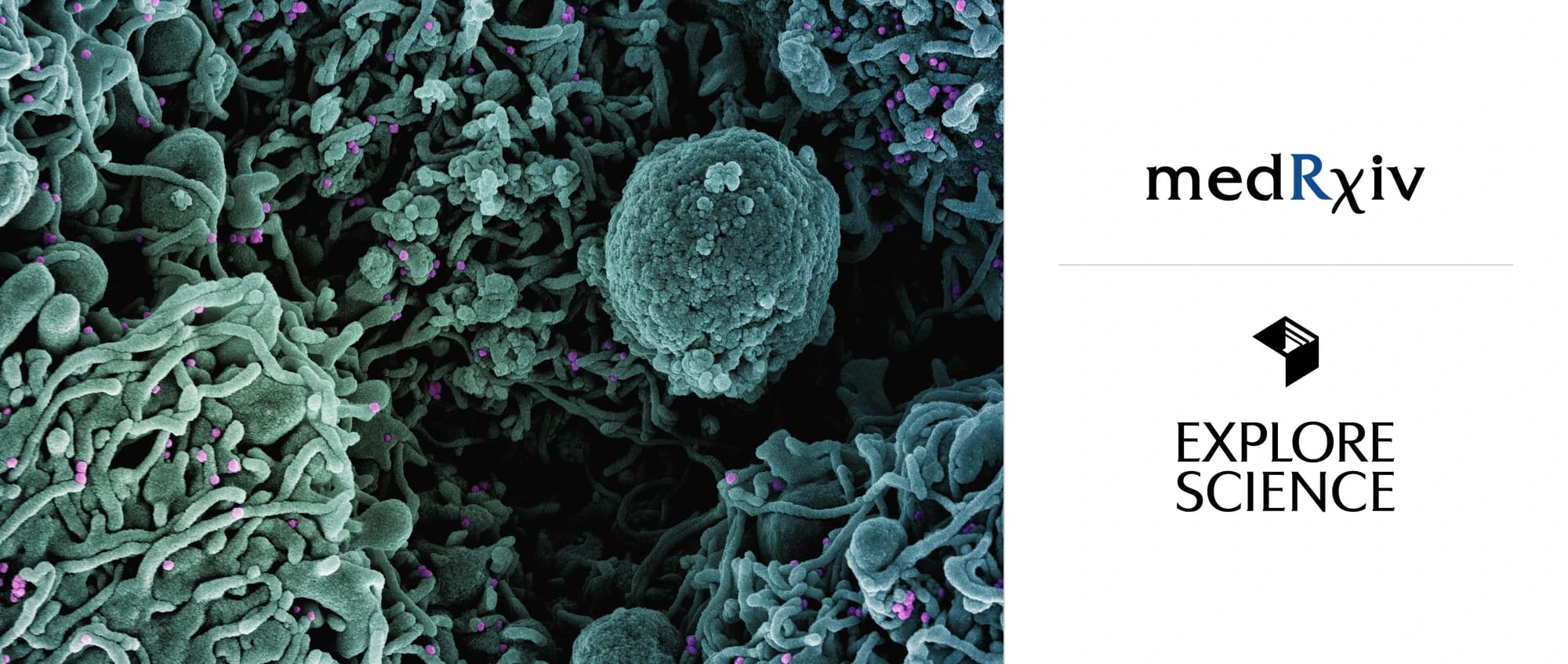 Virus particles, coloured pink, on the surface of cells under a scanning electron microscope, beside the medRxiv and Explore Science logos